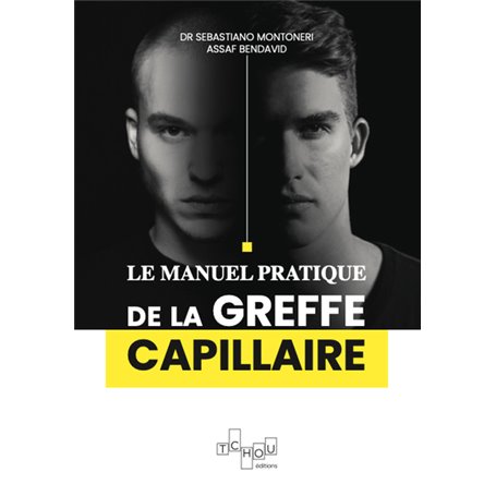 Le manuel pratique de la greffe capillaire