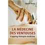 La médecine des ventouses