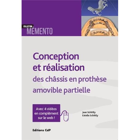 Conception et réalisation des châssis en prothèse amovible partielle