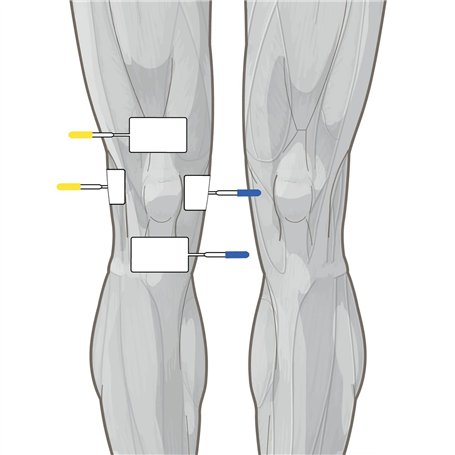 GSRECY Lot de 10 feux de gabarit latéraux à 6 LED 24 V pour camions, feux de position latéraux et arrière - Jaunes