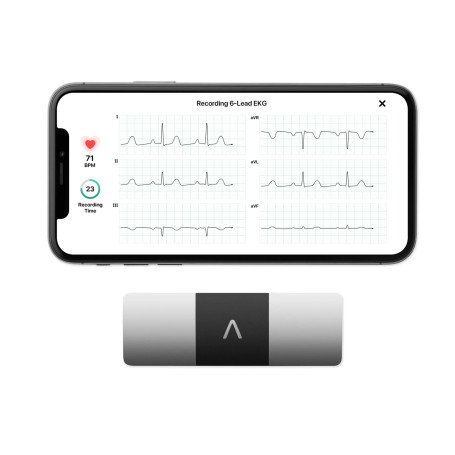 AliveCor KardiaMobile 6L | Le Moniteur ECG Personnel connecté à 6 dérivations. Détectez la Fibrillation auriculaire en Seulement