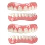 ATFIPAN 2 Pairs-Immédiat Prothèses Dentaires Cosmétiques Silicone Dentier Haut Et Bas Sourire Parfait