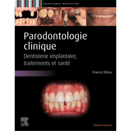Parodontologie clinique