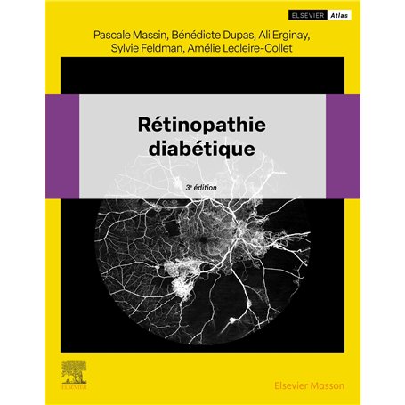 Rétinopathie diabétique