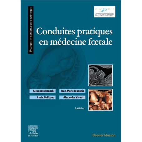 Conduites pratiques en médecine foetale