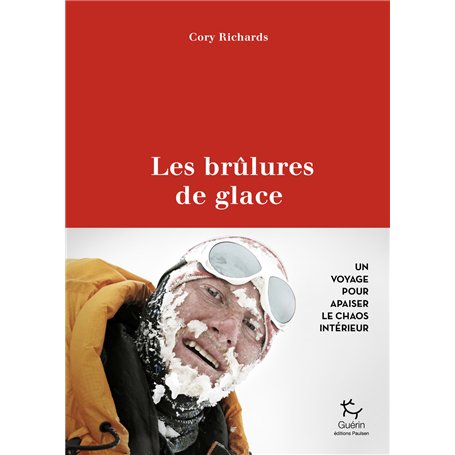 Les brûlures de glace