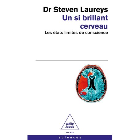 UN SI BRILLANT CERVEAU