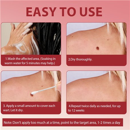 ELCAN 10 Diffuseurs pour torche 36kd. Consommables et accessoires pistolet de soudage. Diffuseurs professionnels résistants pour