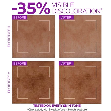 KIMIGO Diamond Painting Accessoires Boite de Rangement