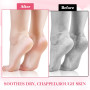 2 paires de chaussettes en silicone pour femme, chaussettes en gel doux, chaussettes à l'aloès, chaussettes hydratantes pour les
