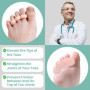 Welnove Hammertoe Correcteur d'orteils en gel – 8 coussinets de soutien d'orteils – Réalignent les orteils, courbés, bouclés, gr