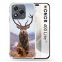 Coque Renforcée Transparente pour Honor 400 Lite 5G - Protection Optimale