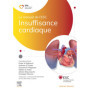 Insuffisance cardiaque