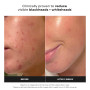 Paula's Choice SKIN PERFECTING 2% BHA Lotion Exfoliante - Gommage Visage avec Acide Salicylique - Réduire les Points Noirs & Por