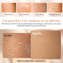 L’Exfose 2x Gant Exfoliant Corps - Gant de Crin Kessa Gommage Corps et Visage en Viscose Naturelle - Élimine les Cellules Mortes