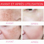 2PC Faded Topicals Cream, Facial Serum, Dark Spot Correcting Glow Sérum,Améliorer Hyperpigmentation,Éclaircir Les Taches Cutanée