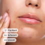 The Ordinary Solution à l'Acide Salicylique 2%, Sérum ciblé pour les peaux sujettes aux imperfections, 30 ml