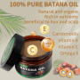 Huile de batana, Huile de batana 100% naturelle pour la croissance des cheveux, Élimine les fourches, restaure les cheveux abîmé