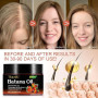 Huile de Batana Bio pour Cheveux 120g, Huile de Batana pour la Croissance des Cheveux, 100% Raw Batana Oil for Hair Growth, élim