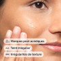 The Ordinary Solution à l'Aloe 2% + NAG 2%, Apaise la peau et élimine les taches post-acnéiques
